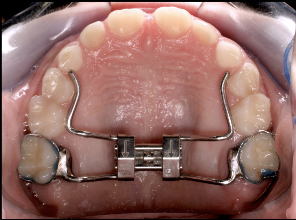 Formation Orthodontie Cycle 2 – Lyon
