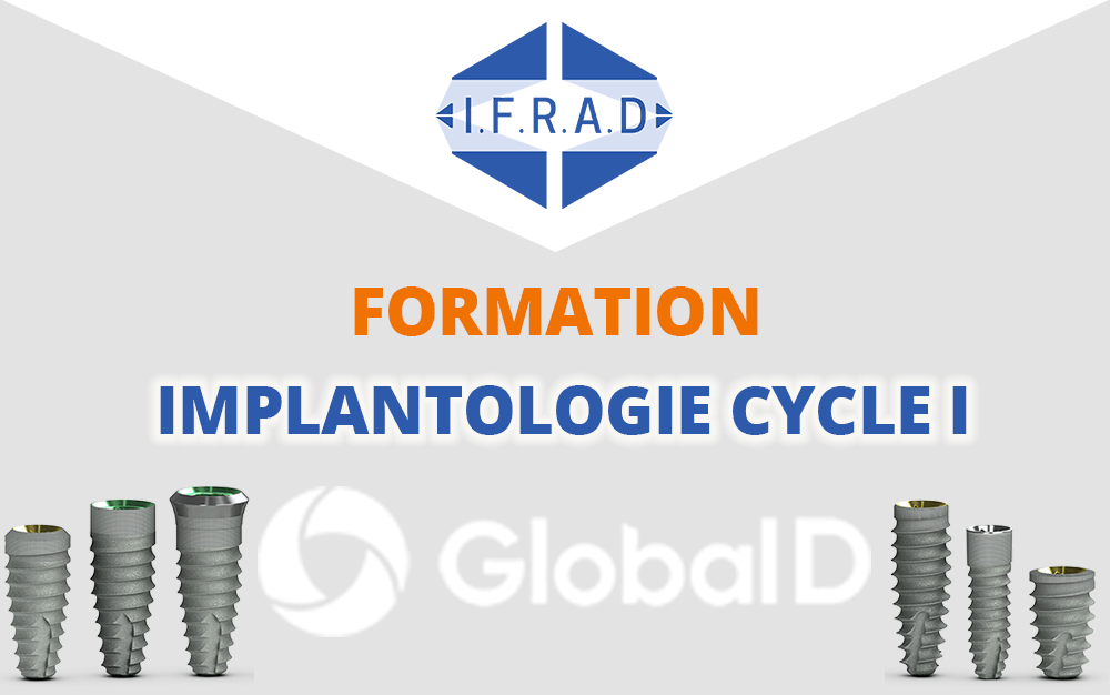 FORMATION IMPLANTOLOGIE GLOBAL D CYCLE 1 – NICE (06)
