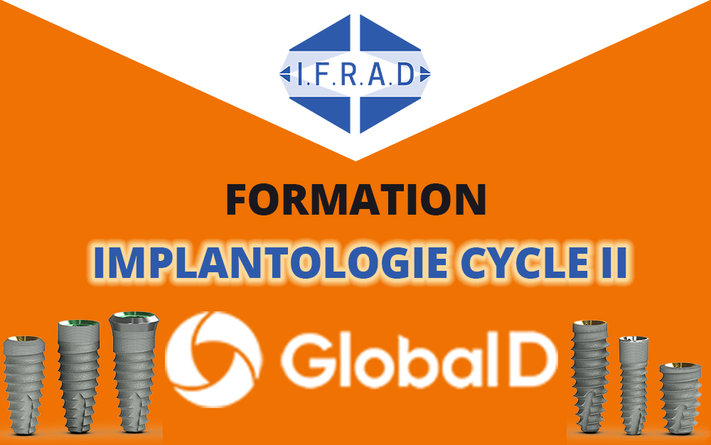 FORMATION IMPLANTOLOGIE GLOBAL D CYCLE 2 – BRIGNAIS (69)